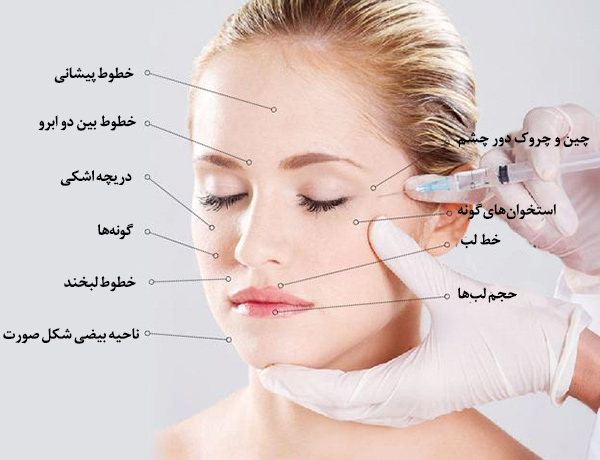 فیلر ابرو چیست و چگونه عمل می‌کند؟ 💉