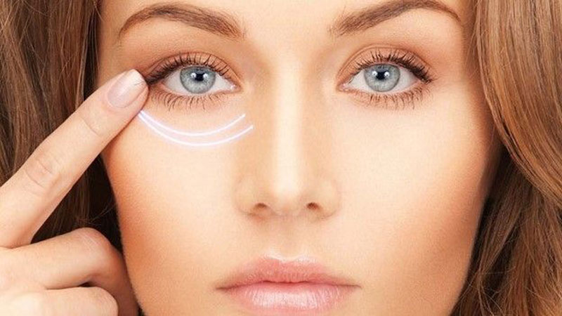 نکات کلیدی برای افزایش ماندگاری فیلر زیر چشم 🌟
