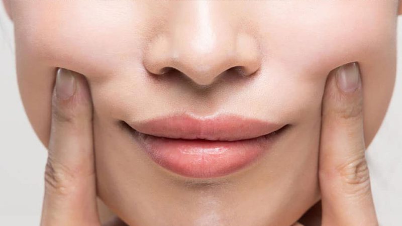 ماندگاری نخ لیفت برای خط خنده ✨🧵