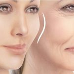 برای خط خنده نخ بهتر است یا ژل؟ ✨🧵