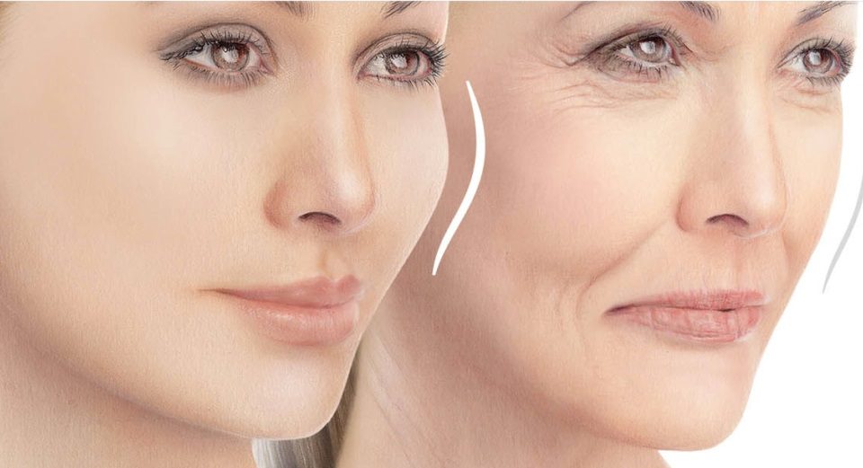 برای خط خنده نخ بهتر است یا ژل؟ ✨🧵