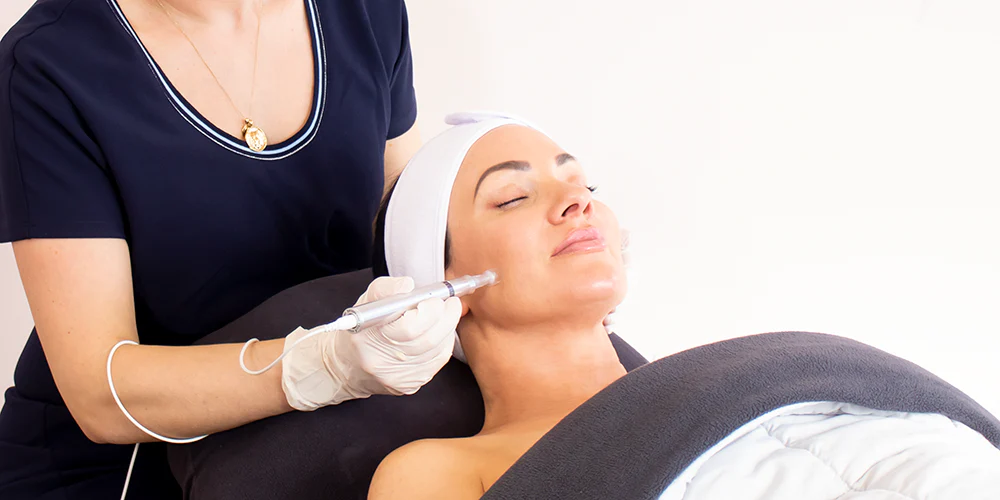 میکرونیدلینگ رفع جای جوش