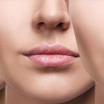 حجم‌دهی به لب‌ها 💋✨