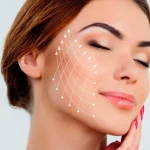 نخ لیفت چند جلسه نیاز دارد؟