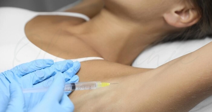 نحوه انجام تزریق بوتاکس زیر بغل 💉