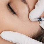 مراقبت‌های بعد از بوتاکس در دوران شیردهی 🍼