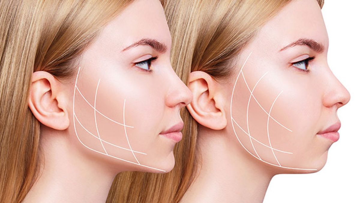فیلر چانه چیست و چگونه عمل می‌کند؟ 💉
