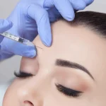 تأثیر بوتاکس در رفع خط اخم