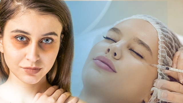 مراقبت‌های مؤثر برای کاهش ورم و کبودی 🧊