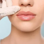 ماندگاری فیلر لب 💋💉