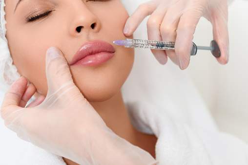 ماندگاری فیلر لب 💋💉