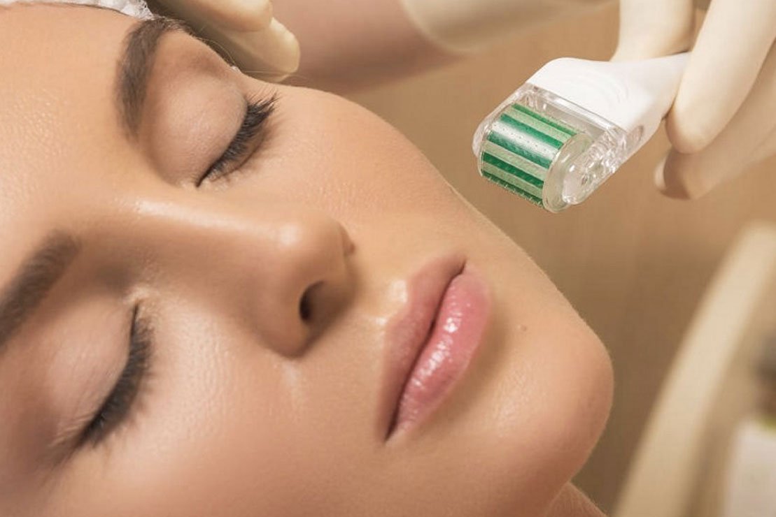 میکرونیدلینگ رفع جای جوش