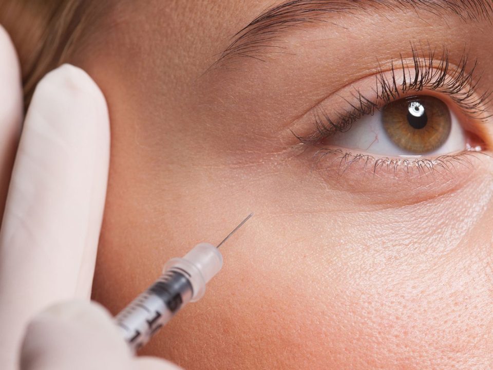 عوارض و خطرات فیلر زیر چشم 👁⚠️