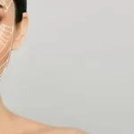 ماندگاری نخ لیفت برای خط خنده ✨🧵