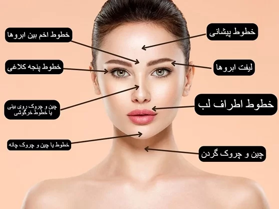 تزریق بوتاکس در کجاها انجام می‌شود؟