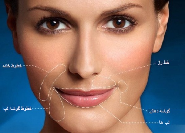 خط خنده چیست و چرا ایجاد می‌شود 💉