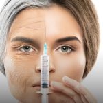 عوارض و مراقبت‌های بعد از تزریق فیلر 💉✨
